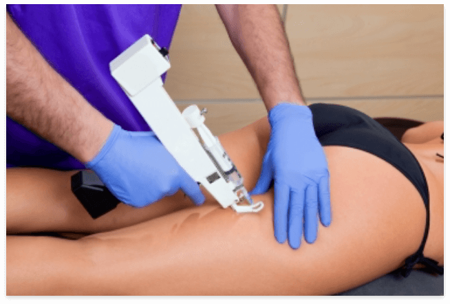 Mesotherapie_header_image